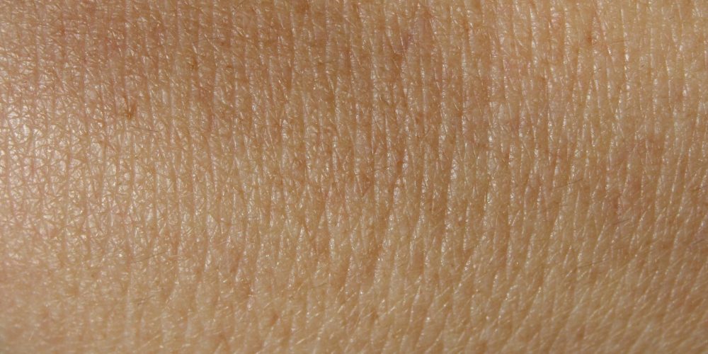 Principales causas de la falta de pigmento en la piel