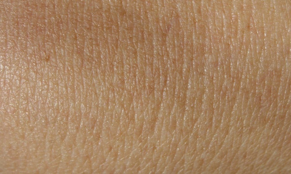principales causas de la falta de pigmento en la piel