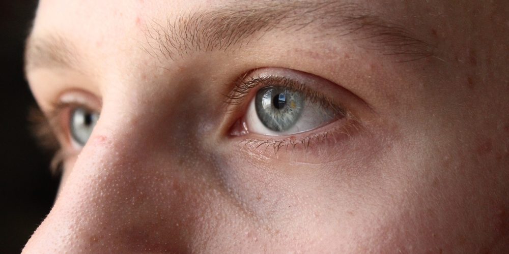 Más tipos de piel que la normal, seca y grasa