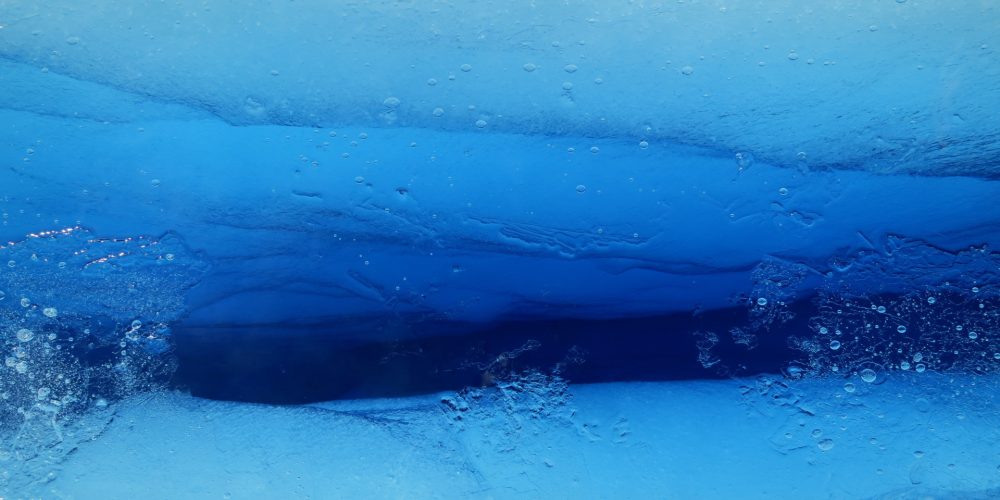 Y congelarán tu corazón latiendo mientras esperas una posible resurrección