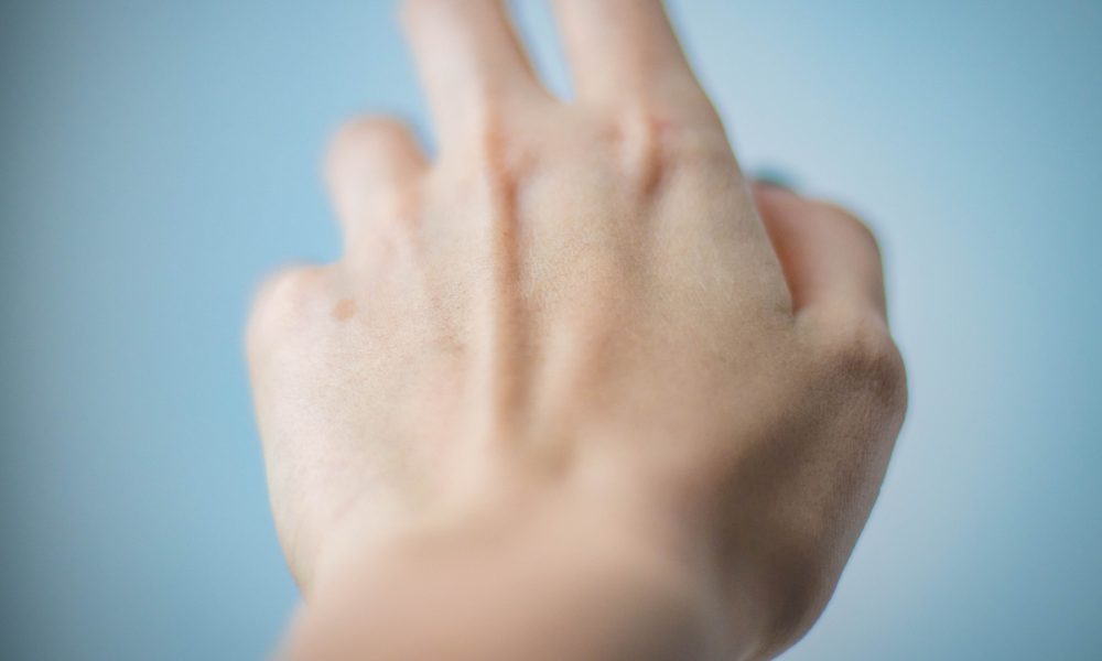 bacterias-propias-de-la-pie-que-protegen-del-cancer-segun-un-estudio-1920