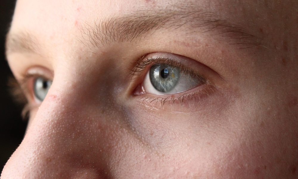 más tipos de piel que normal seca o grasa