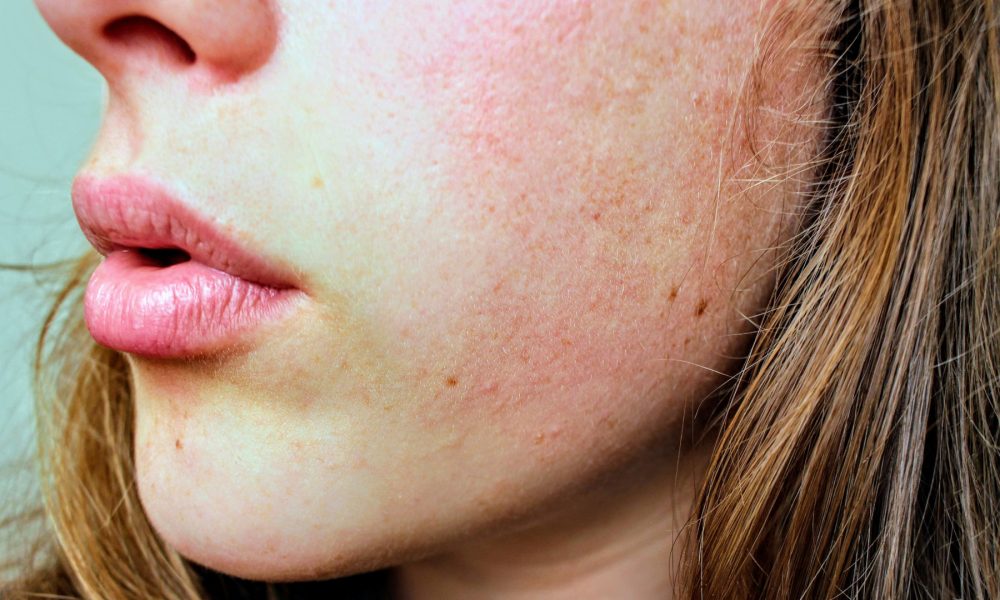 todo-lo-que-debes-tener-claro-sobre-la-hidratacion-cutanea-1920