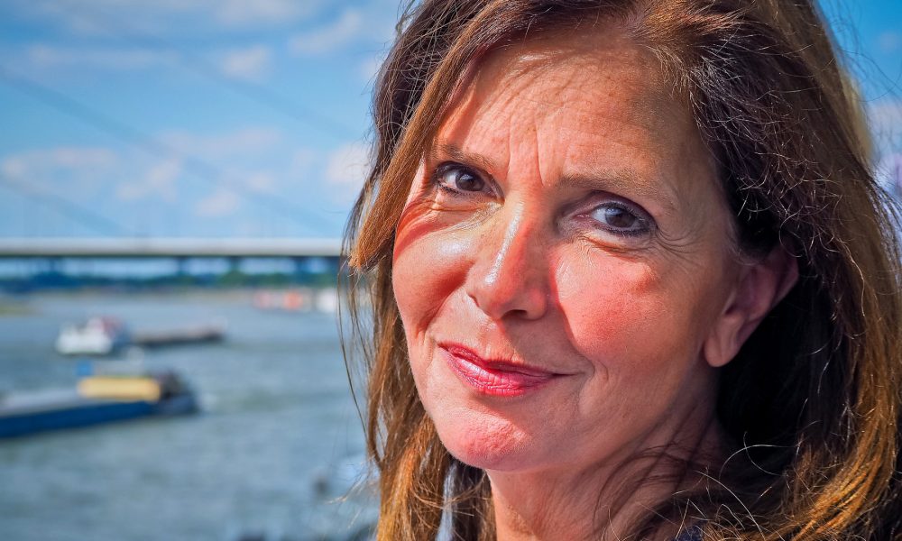 melasma un tipo de hiperpigmentación de la piel