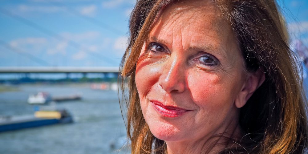Melasma, un tipo de hiperpigmentación de la piel
